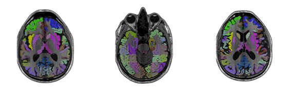 brains