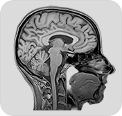 brain2d